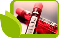 Как да разчитаме кръвните изследвания, тестове, ПКК