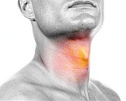 Възпалено гърло – лечение, хранене, аромотерапия