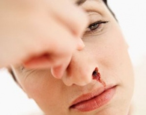 Кръвотечение от носа – практически съвети