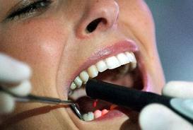 Абцес на зъб - лечение аромотерапия, билки